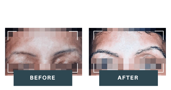 eyeborw-before-after-neww1