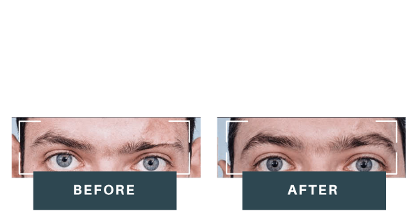 eyeborw-before-after-neww2